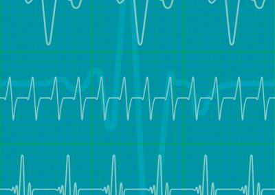 Fabrics - Fashion Patterns - 1257 Poly EKG