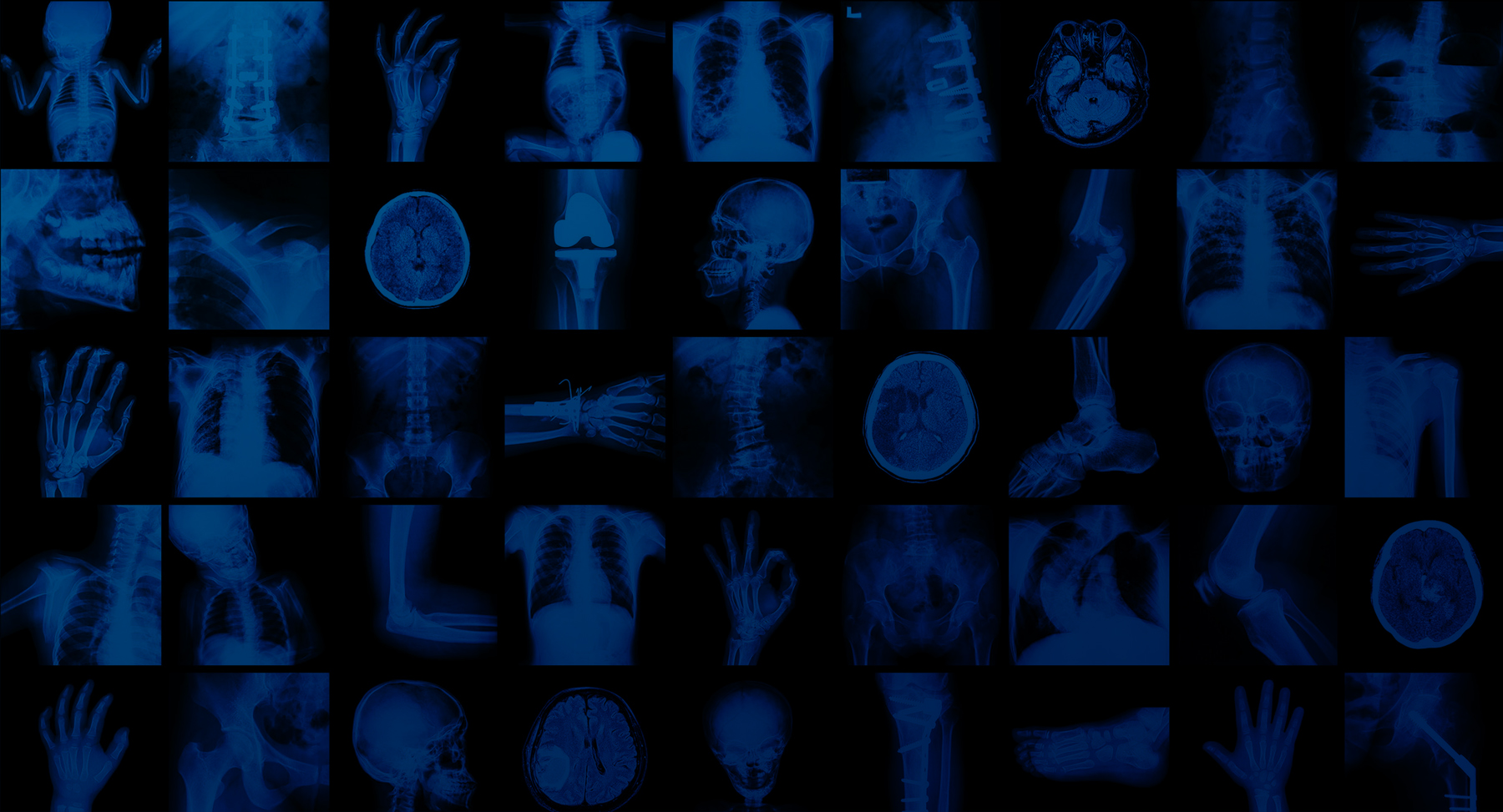 01_ApronsBluebackgrounde1561570805995 Burlington Medical